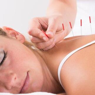 Acupuncture, up-to-date,